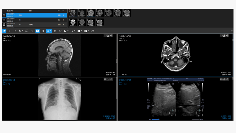 DICOM画像表示Viewer M-Viewer